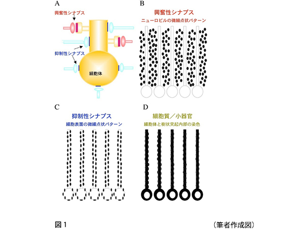図1　想定される免疫染色パターン