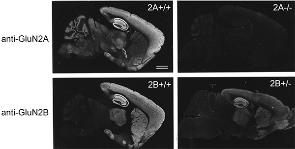 図4　ペプシン処理法の効果（NMDA受容体GluN2A, GluN2Bサブユニット）とその特異性